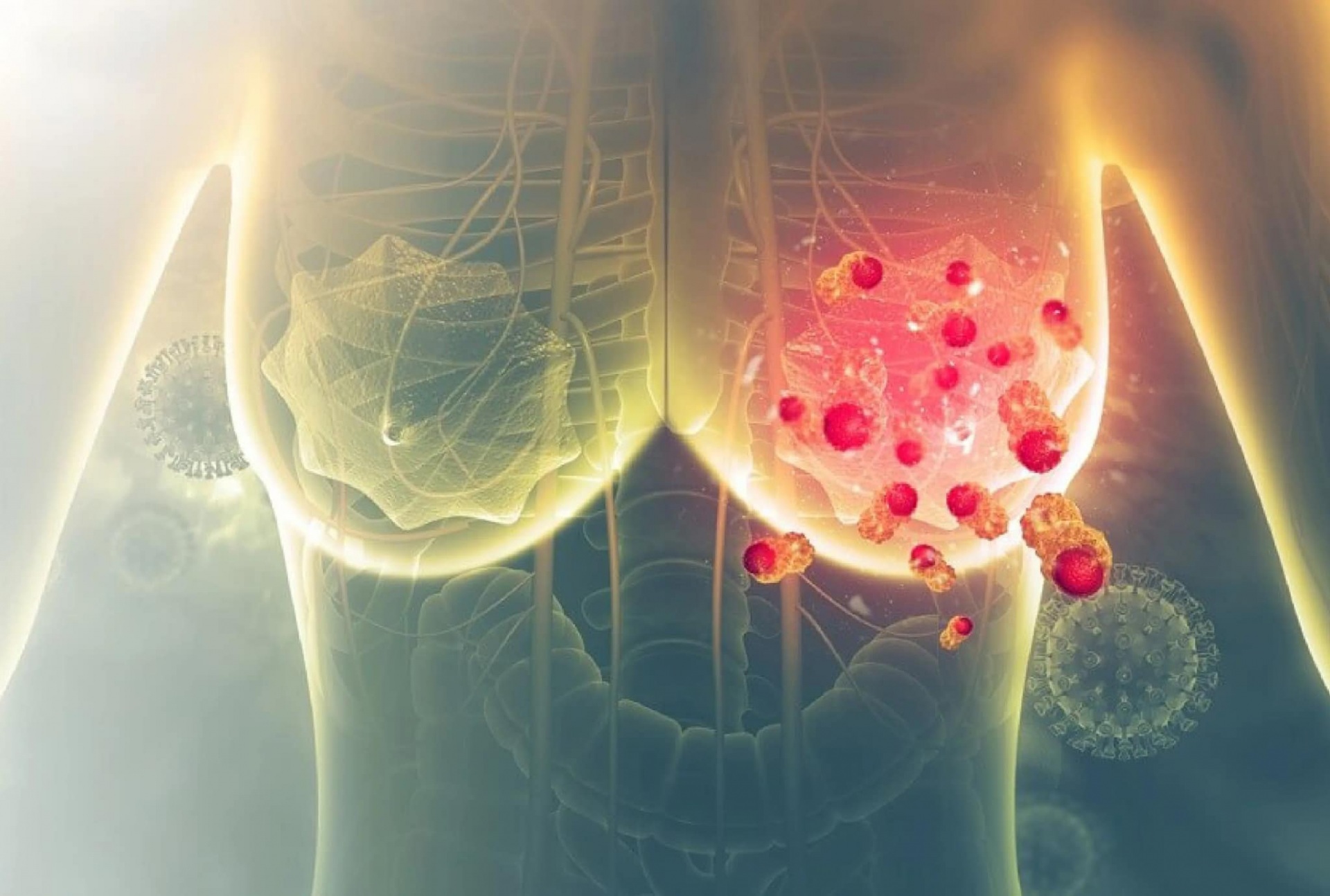 dấu hiệu sớm ung thư vú y duoc thai nguyen