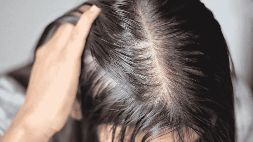 nguyên nhân rụng tóc y duoc thai nguyen