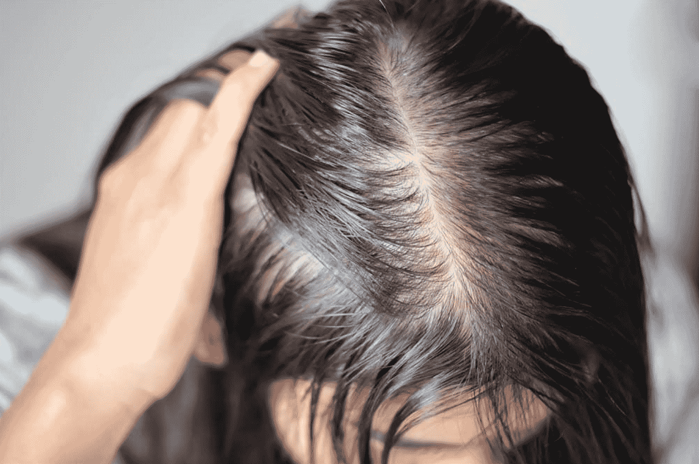 nguyên nhân rụng tóc y duoc thai nguyen