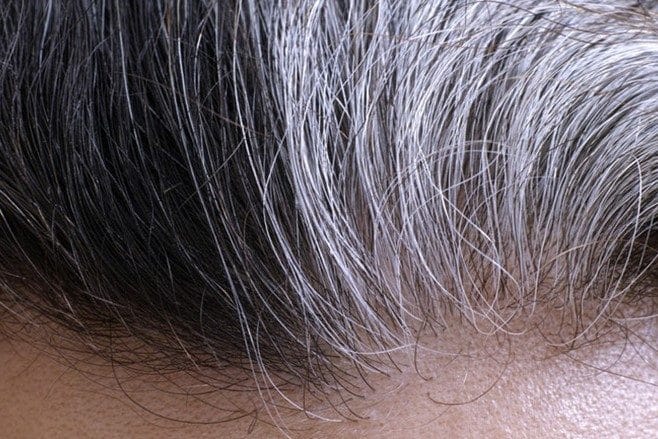 nguyên nhân tóc bạc sớm y duoc thai nguyen