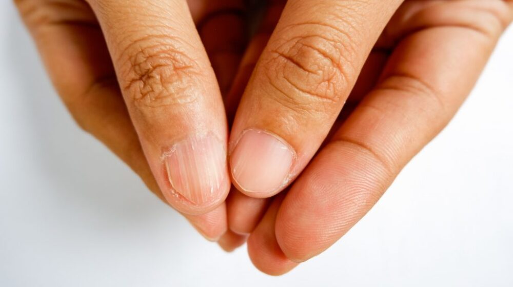 thiếu máu gây bệnh ung thư y duoc thai nguyen