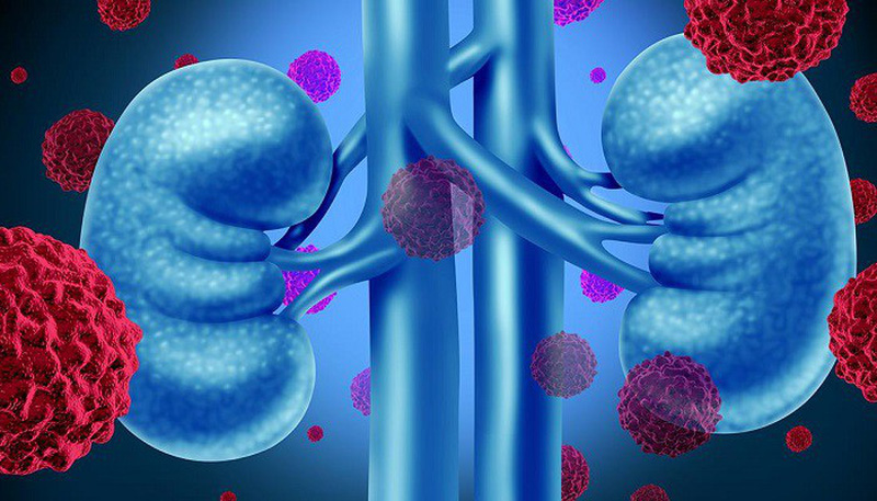 ung thư thận y duoc thai nguyen