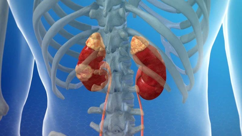 ung thư thận y duoc thai nguyen