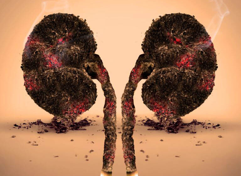 ung thư thận y duoc thai nguyen