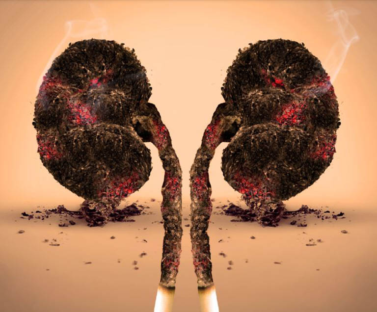 ung thư thận y duoc thai nguyen