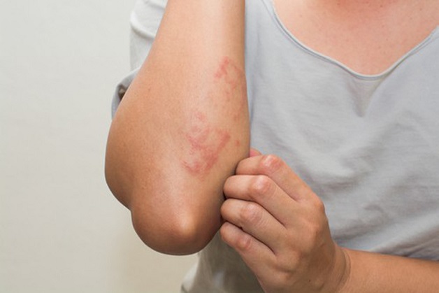bệnh lây truyền qua đường tình dục ở tuổi trung niên y duoc thai nguyen