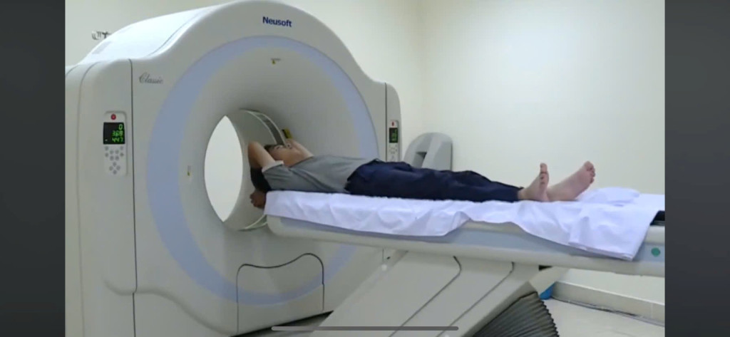 chụp CT liều thấp phát hiện ung thư y duoc thai nguyen
