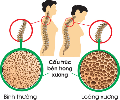 mận khô tăng cường sức khoẻ xường khớp y duoc thai nguyen