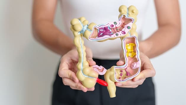 phát hiện sớm ung thư đại trực tràng y duoc thai nguyen